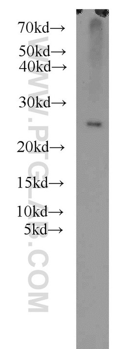 RPB5 Rabbit anti-Human, Mouse, Rat, Polyclonal, Proteintech:Antibodies:Primary