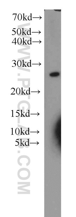 RPB5 Rabbit anti-Human, Mouse, Rat, Polyclonal, Proteintech:Antibodies:Primary