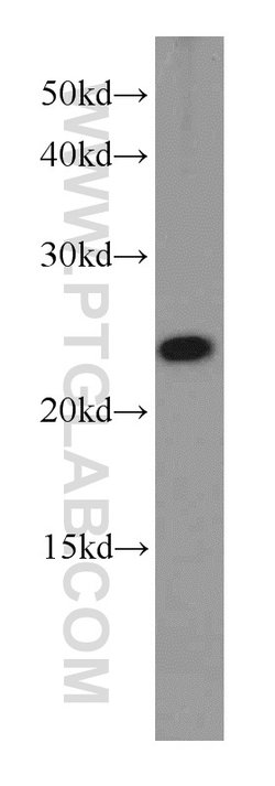 RPB5 Rabbit anti-Human, Mouse, Rat, Polyclonal, Proteintech:Antibodies:Primary