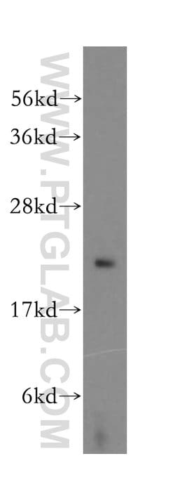 RPB5 Rabbit anti-Human, Mouse, Rat, Polyclonal, Proteintech:Antibodies:Primary