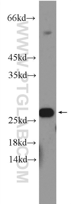 RPB5 Rabbit anti-Human, Mouse, Rat, Polyclonal, Proteintech:Antibodies:Primary