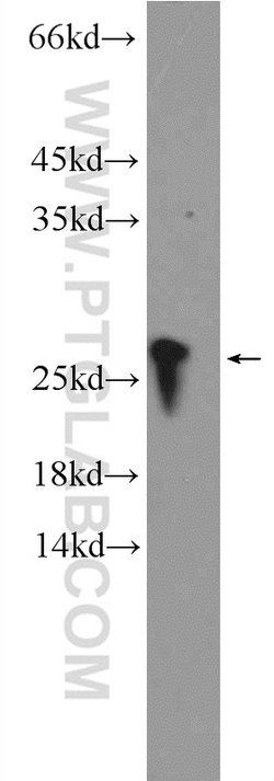 RPB5 Rabbit anti-Human, Mouse, Rat, Polyclonal, Proteintech:Antibodies:Primary