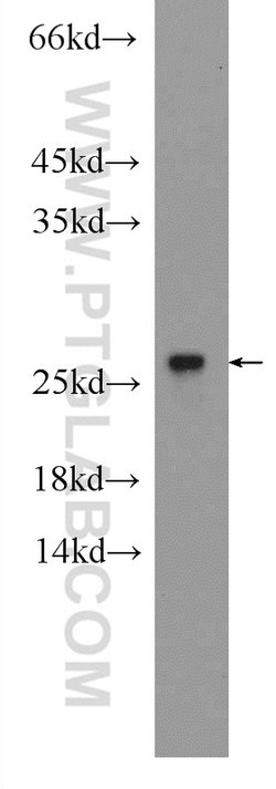 RPB5 Rabbit anti-Human, Mouse, Rat, Polyclonal, Proteintech:Antibodies:Primary