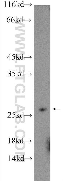 RPB5 Rabbit anti-Human, Mouse, Rat, Polyclonal, Proteintech:Antibodies:Primary