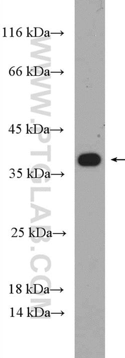 RPAIN Rabbit anti-Human, Mouse, Polyclonal, Proteintech 150 &mu;L; Unconjugated:Antibodies,