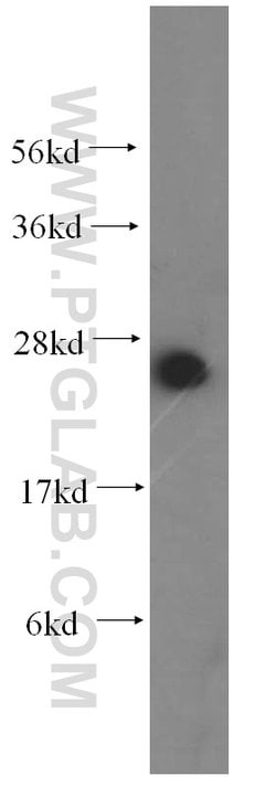 RPL21 Rabbit anti-Human, Mouse, Rat, Polyclonal, Proteintech 150 &mu;L;