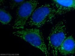 MRPL34 Rabbit anti-Human, Mouse, Rat, Polyclonal, Proteintech:Antibodies:Primary