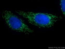 SLC25A1 Rabbit anti-Human, Mouse, Rat, Polyclonal, Proteintech:Antibodies:Primary