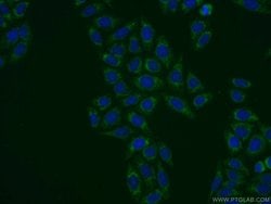 SLC25A1 Rabbit anti-Human, Mouse, Rat, Polyclonal, Proteintech:Antibodies:Primary