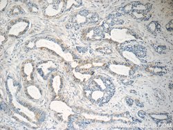 SLC25A1 Rabbit anti-Human, Mouse, Rat, Polyclonal, Proteintech:Antibodies:Primary