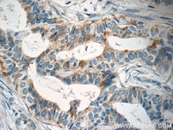 SLC25A1 Rabbit anti-Human, Mouse, Rat, Polyclonal, Proteintech:Antibodies:Primary