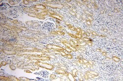 SLC25A1 Rabbit anti-Human, Mouse, Rat, Polyclonal, Proteintech:Antibodies:Primary