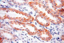 SLC25A1 Rabbit anti-Human, Mouse, Rat, Polyclonal, Proteintech:Antibodies:Primary