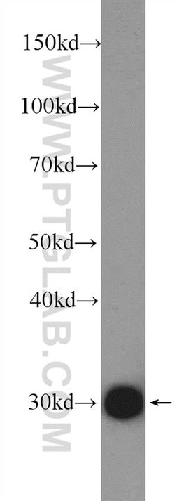 SLC25A1 Rabbit anti-Human, Mouse, Rat, Polyclonal, Proteintech:Antibodies:Primary