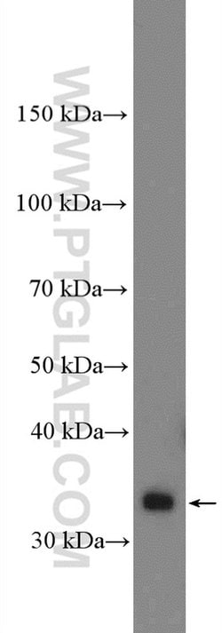 SLC25A1 Rabbit anti-Human, Mouse, Rat, Polyclonal, Proteintech:Antibodies:Primary
