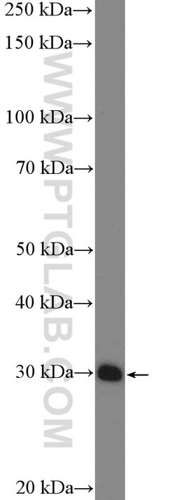 SLC25A1 Rabbit anti-Human, Mouse, Rat, Polyclonal, Proteintech:Antibodies:Primary