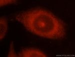 Thumbnail_NCK1 Rabbit anti-Human, Mouse, Rat, Polyclonal, Proteintech 150 &mu;L;