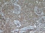 Thumbnail_NCK1 Rabbit anti-Human, Mouse, Rat, Polyclonal, Proteintech 150 &mu;L;