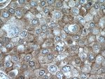 Thumbnail_NCK1 Rabbit anti-Human, Mouse, Rat, Polyclonal, Proteintech 150 &mu;L;