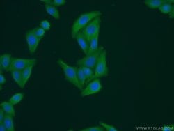 GEMIN8 Rabbit anti-Human, Polyclonal, Proteintech:Antibodies:Primary Antibodies