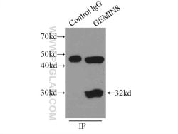 GEMIN8 Rabbit anti-Human, Polyclonal, Proteintech:Antibodies:Primary Antibodies