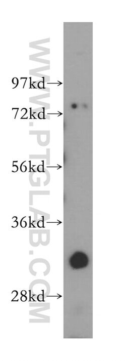 GEMIN8 Rabbit anti-Human, Polyclonal, Proteintech:Antibodies:Primary Antibodies