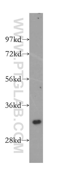 GEMIN8 Rabbit anti-Human, Polyclonal, Proteintech:Antibodies:Primary Antibodies