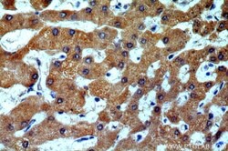 H6PD Rabbit anti-Human, Mouse, Rat, Polyclonal, Proteintech 150 &mu;L;