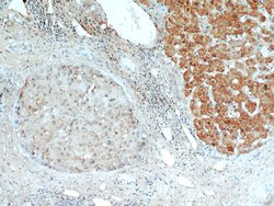 H6PD Rabbit anti-Human, Mouse, Rat, Polyclonal, Proteintech 150 &mu;L;