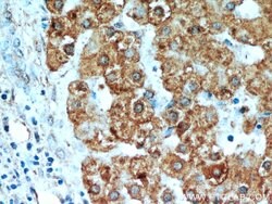 H6PD Rabbit anti-Human, Mouse, Rat, Polyclonal, Proteintech 150 &mu;L;