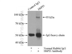 H6PD Rabbit anti-Human, Mouse, Rat, Polyclonal, Proteintech 150 &mu;L;