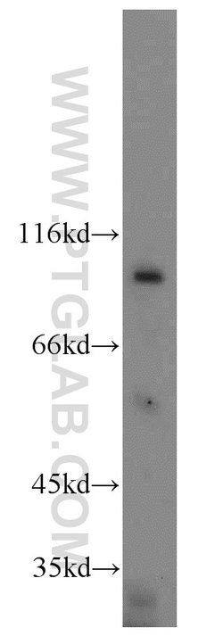 H6PD Rabbit anti-Human, Mouse, Rat, Polyclonal, Proteintech 150 &mu;L;