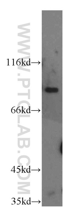 H6PD Rabbit anti-Human, Mouse, Rat, Polyclonal, Proteintech 150 &mu;L;