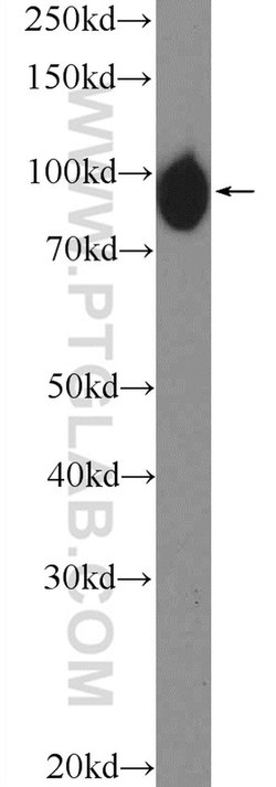 H6PD Rabbit anti-Human, Mouse, Rat, Polyclonal, Proteintech 150 &mu;L;
