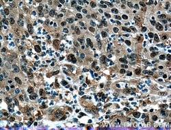 PSMD13 Rabbit anti-Human, Polyclonal, Proteintech 150 &mu;L; Unconjugated:Antibodies,