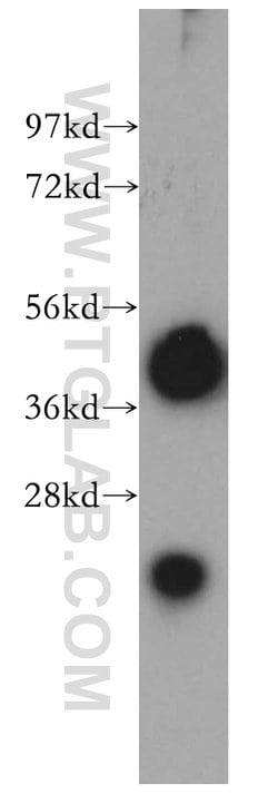 TMOD2 Rabbit anti-Human, Mouse, Rat, Polyclonal, Proteintech:Antibodies:Primary
