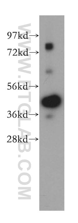 TMOD2 Rabbit anti-Human, Mouse, Rat, Polyclonal, Proteintech:Antibodies:Primary