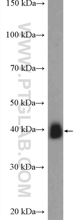 TMOD2 Rabbit anti-Human, Mouse, Rat, Polyclonal, Proteintech:Antibodies:Primary