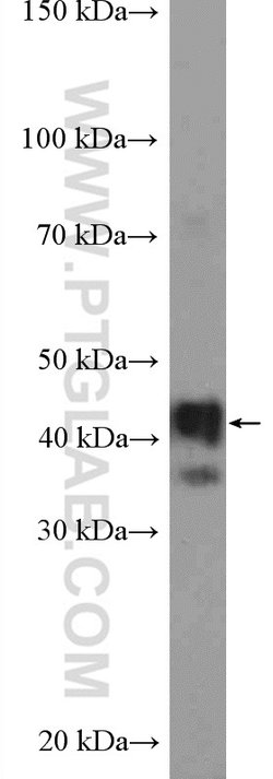 TMOD2 Rabbit anti-Human, Mouse, Rat, Polyclonal, Proteintech:Antibodies:Primary