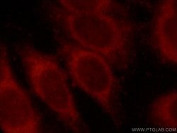 MLYCD Rabbit anti-Human, Mouse, Rat, Polyclonal, Proteintech 150 &mu;L;
