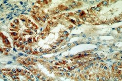 MLYCD Rabbit anti-Human, Mouse, Rat, Polyclonal, Proteintech 150 &mu;L;