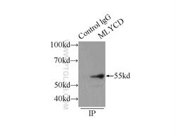 MLYCD Rabbit anti-Human, Mouse, Rat, Polyclonal, Proteintech 150 &mu;L;