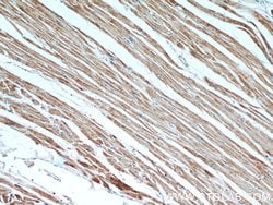 MLYCD Rabbit anti-Human, Mouse, Rat, Polyclonal, Proteintech 150 &mu;L;