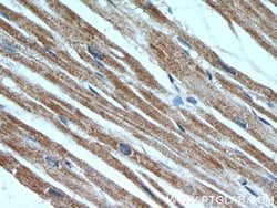 MLYCD Rabbit anti-Human, Mouse, Rat, Polyclonal, Proteintech 150 &mu;L;