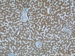 MLYCD Rabbit anti-Human, Mouse, Rat, Polyclonal, Proteintech 150 &mu;L;