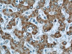MLYCD Rabbit anti-Human, Mouse, Rat, Polyclonal, Proteintech 150 &mu;L;