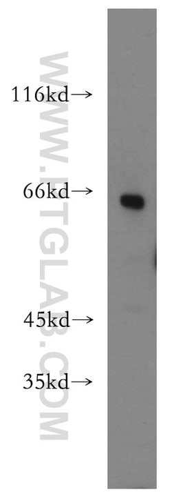 MLYCD Rabbit anti-Human, Mouse, Rat, Polyclonal, Proteintech 150 &mu;L;