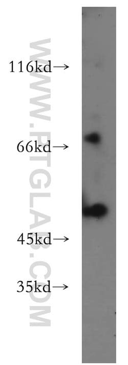 MLYCD Rabbit anti-Human, Mouse, Rat, Polyclonal, Proteintech 150 &mu;L;