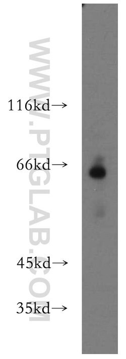 MLYCD Rabbit anti-Human, Mouse, Rat, Polyclonal, Proteintech 150 &mu;L;