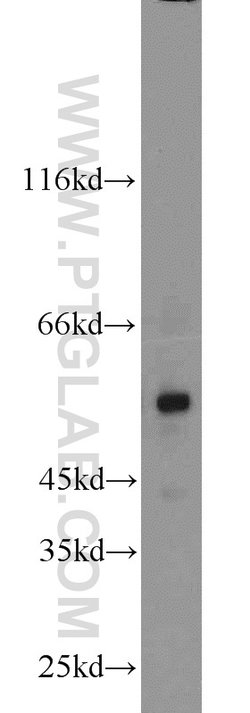 MLYCD Rabbit anti-Human, Mouse, Rat, Polyclonal, Proteintech 150 &mu;L;